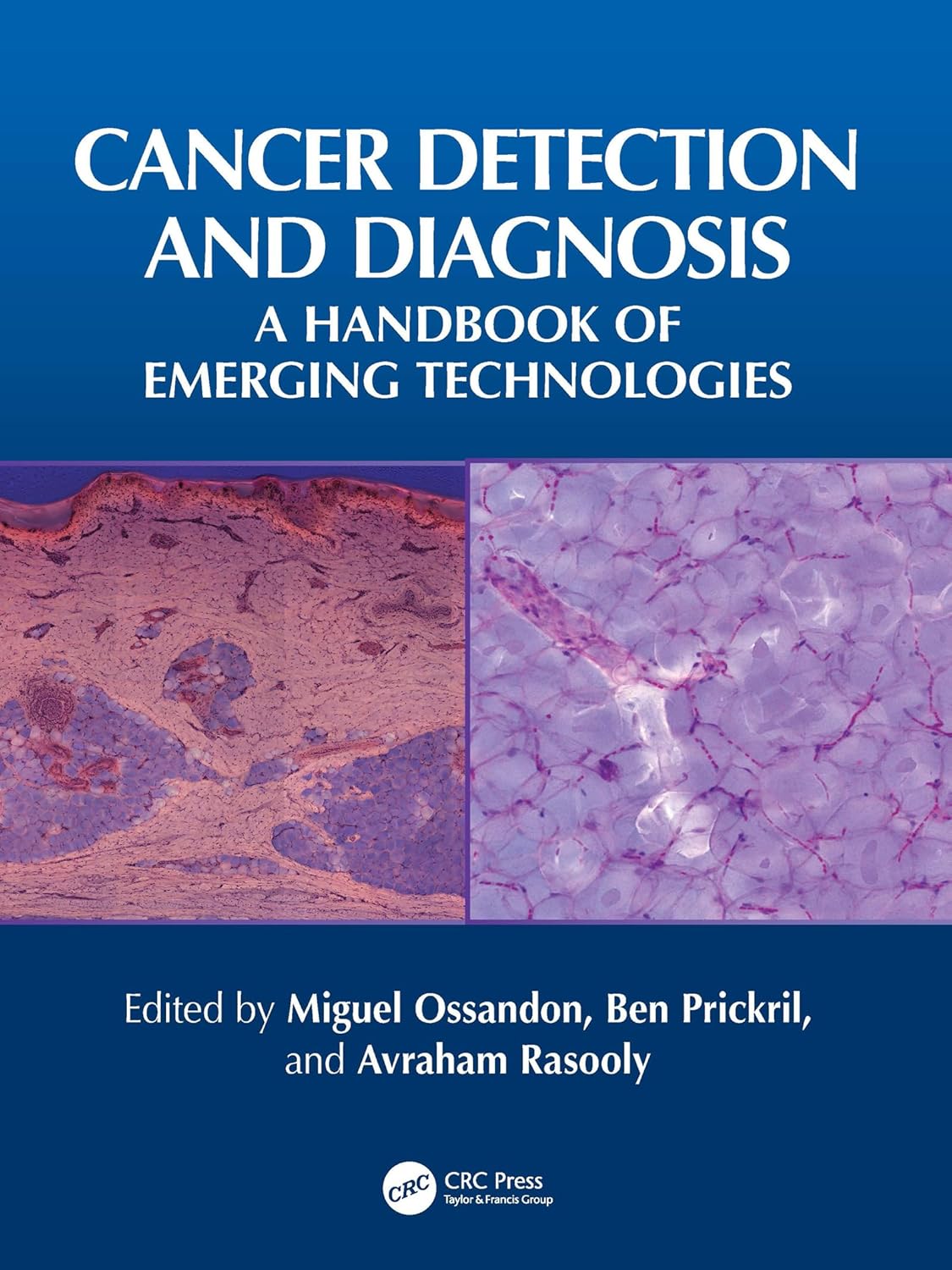 Cancer Detection and Diagnosis: A Handbook of Emerging Technologies (PDF) Cancer Detection and Diagnosis: A Handbook of Emerging Technologies (PDF)