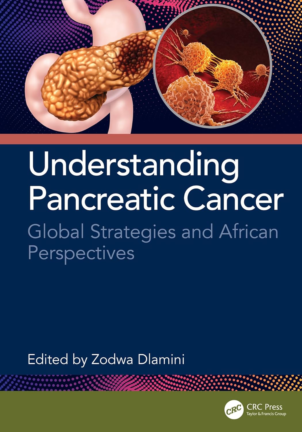 Understanding Pancreatic Cancer: Global Strategies and African Perspectives (EPUB) Understanding Pancreatic Cancer: Global Strategies and African Perspectives (EPUB)
