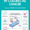 Advancements in Colorectal Cancer (PDF)