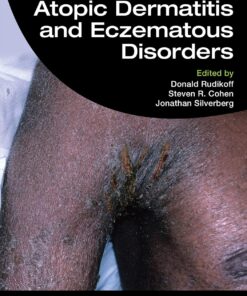 Atopic Dermatitis and Eczematous Disorders, 2nd Edition (EPUB)