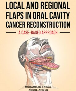 Local and Regional Flaps in Oral Cavity Cancer Reconstruction: A case-based approach (EPUB)