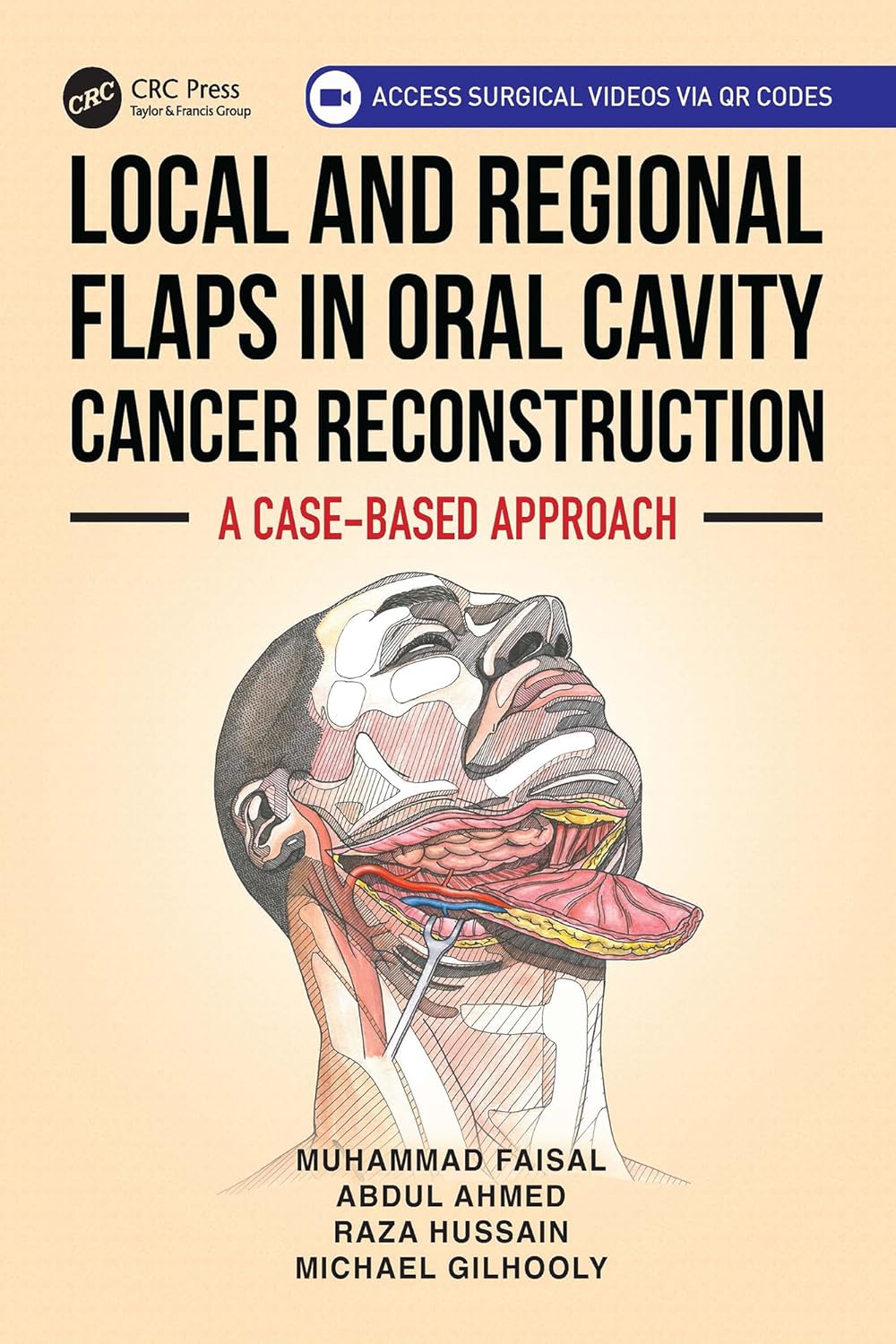 Local and Regional Flaps in Oral Cavity Cancer Reconstruction: A case-based approach (EPUB) Local and Regional Flaps in Oral Cavity Cancer Reconstruction: A case-based approach (EPUB)