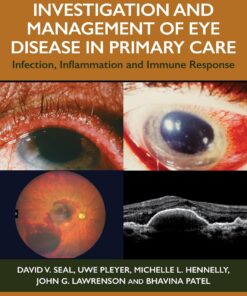 Investigation & Management of Eye Disease in Primary Care: Infection, Inflammation and Immune Response (EPUB)