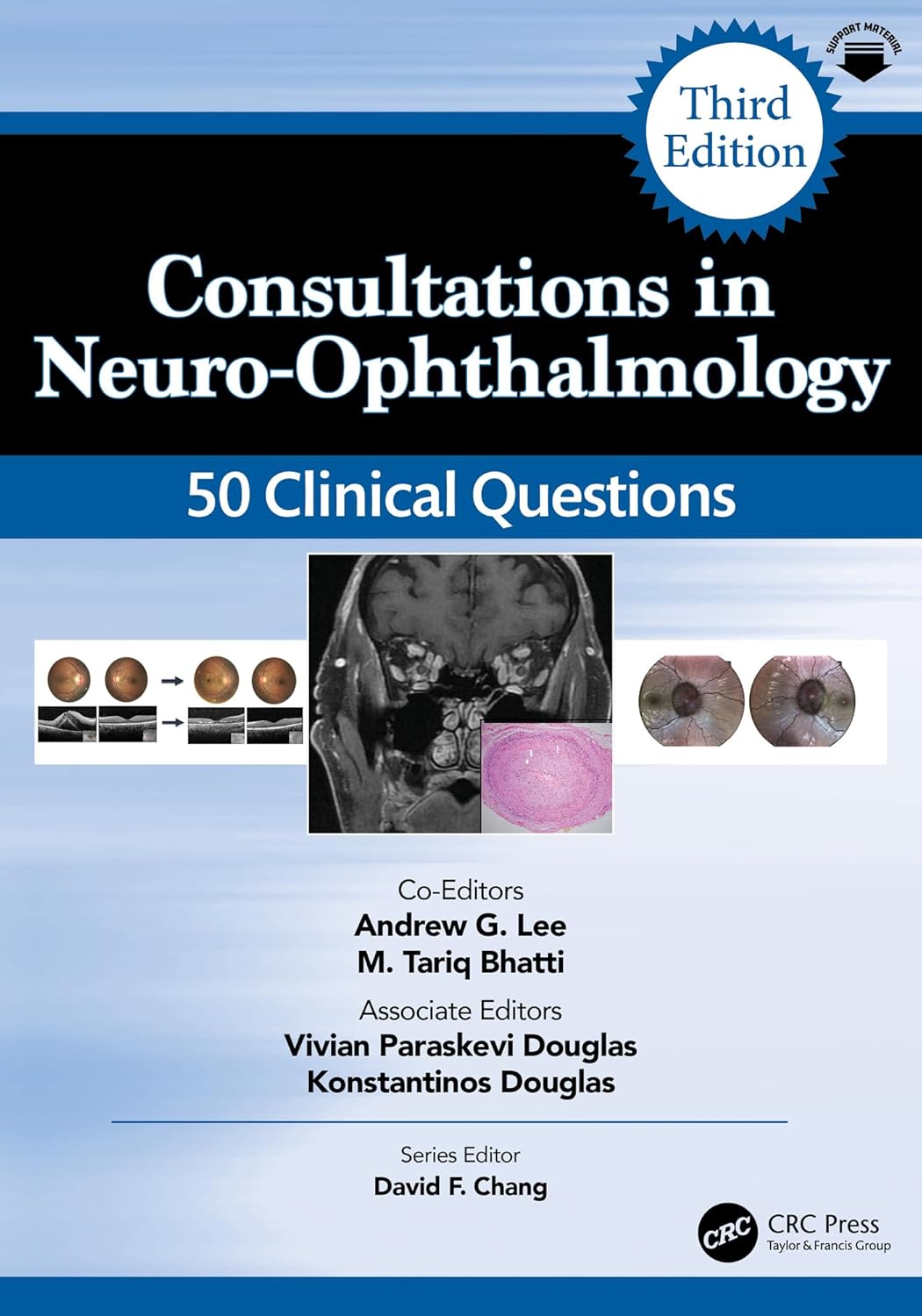 Consultations in Neuro-Ophthalmology: 50 Clinical Questions (Curbside Consultation in Ophthalmology), 3rd Edition (EPUB) Consultations in Neuro-Ophthalmology: 50 Clinical Questions (Curbside Consultation in Ophthalmology), 3rd Edition (EPUB)