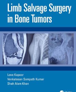 Limb Salvage Surgery in Bone Tumors (PDF)