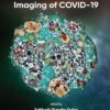 Ultrastructural Imaging of COVID-19 (EPUB)