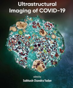 Ultrastructural Imaging of COVID-19 (EPUB)