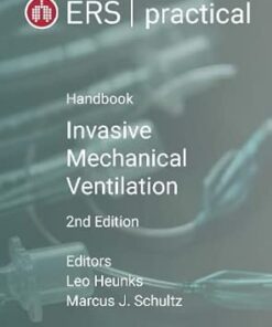 ERS Practical Handbook of Invasive Mechanical Ventilation, 2nd Edition (EPUB)
