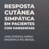 Resposta cutânea simpática em pacientes com Hanseníase: Uma doença ainda endêmica no Brasil (Portuguese Edition) (EPUB)