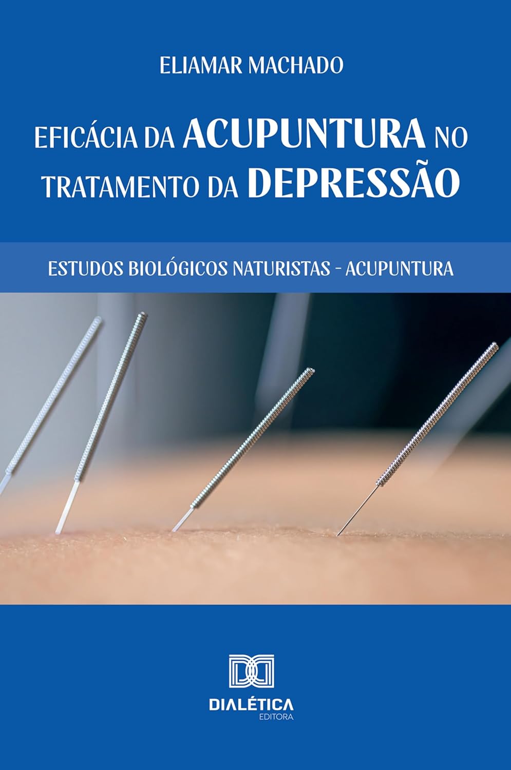 Eficácia da Acupuntura no Tratamento da Depressão: Estudos Biológicos Naturistas – Acupuntura (Portuguese Edition) (EPUB) Eficácia da Acupuntura no Tratamento da Depressão: Estudos Biológicos Naturistas – Acupuntura (Portuguese Edition) (EPUB)