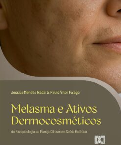 Melasma e Ativos Dermocosméticos: da Fisiopatologia ao Manejo Clínico em Saúde Estética (Portuguese Edition) (EPUB)
