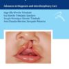 Cleft Lip and Palate: Advances in Diagnosis and Interdisciplinary Care (Portuguese Edition) (EPUB)