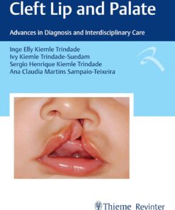 Cleft Lip and Palate: Advances in Diagnosis and Interdisciplinary Care (Portuguese Edition) (EPUB)