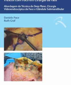 Guia de Dissecção Anatômica em Cadáveres Frescos com Foco em Cirurgia da Face: Abordagem da Técnica de Deep Plane, Cirurgia Videoendoscópica da ace e Glândula Submandibular (Portuguese Edition) (EPUB)