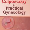 Colposcopy in Practical Gynecology (EPUB)
