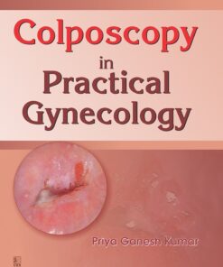 Colposcopy in Practical Gynecology (EPUB)