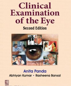 Clinical Examination of the Eye, 2nd Edition (EPUB)