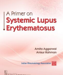 A Primer on Lupus Systematic Erythematosus (PDF)