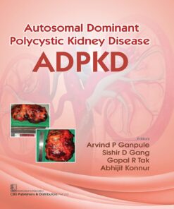 Autosomal Dominant Polytechnic Kidney Disease ADPKD (PDF)