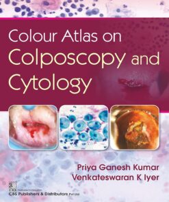 Colour Atlas on Colposcpoy and Cytology (PDF)