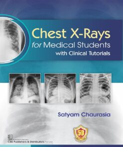 Chest X-ray for Medical Students with Clinical Tutorials (PDF)