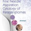 An Atlas of Fine Needle Aspiration Cytology of Paragangliomas (PDF)