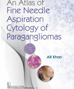 An Atlas of Fine Needle Aspiration Cytology of Paragangliomas (PDF)