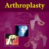 Arthroplasty (EPUB)