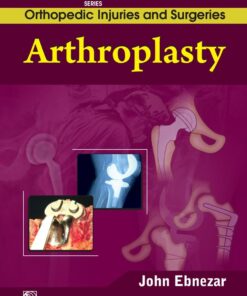 Arthroplasty (EPUB)