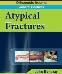 Atypical Fractures (EPUB)