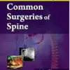 Common Surgeries of Spine (EPUB) Common Surgeries of Spine (EPUB)