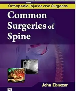 Common Surgeries of Spine (EPUB)