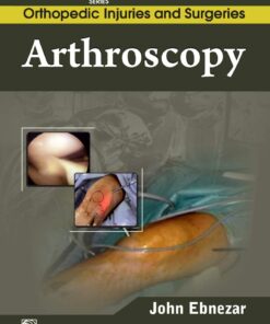 Arthroscopy (EPUB)