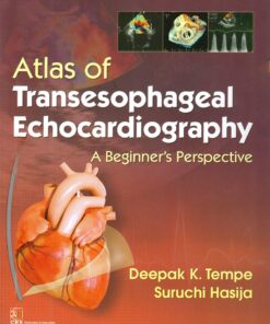 Atlas of Transesophageal Echocardiography A Beginner’s Perspective: A Beginners Perspective, 2nd Edition (EPUB)