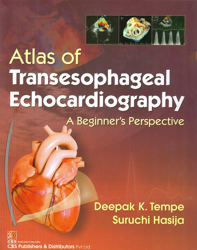 Atlas of Transesophageal Echocardiography A Beginner’s Perspective: A Beginners Perspective, 2nd Edition (EPUB) Atlas of Transesophageal Echocardiography A Beginner’s Perspective: A Beginners Perspective, 2nd Edition (EPUB)