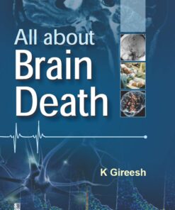 All About Brain Death (EPUB)