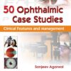 50 Ophthalmic Case Studies Clinical Features and Management (PDF)