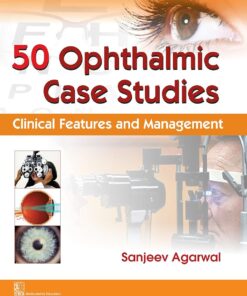50 Ophthalmic Case Studies Clinical Features and Management (PDF)
