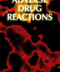 Adverse Drug Reaction (EPUB)