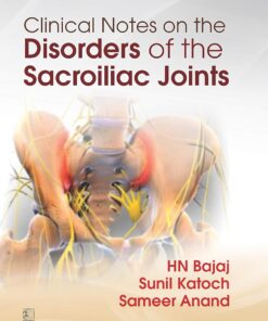 Clinical Notes on the Disorders of Sacroiliac Joints (PDF)