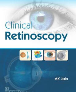 Clinical Retinoscopy (EPUB)