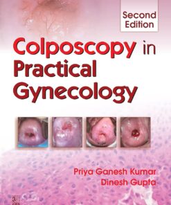 Colposcopy in Practical Gynaecology (PDF)