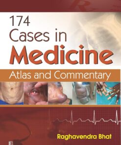 174 cases in Medicine (PDF)