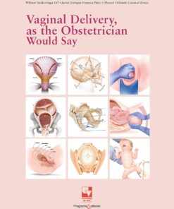 Vaginal Delivery, as the Obstetrician Would Say (Spanish Edition) (PDF)