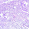 Gynecologic Pathology: Masters of Pathology Series 2026 (Videos + PDF)