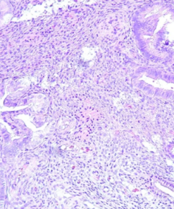 Gynecologic Pathology: Masters of Pathology Series 2026 (Videos + PDF)