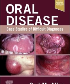 Oral Disease: Case Studies of Difficult Diagnoses (EPUB)