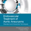 Endovascular Treatment of Aortic Aneurysms: Standard and Advanced Techniques (EPUB)
