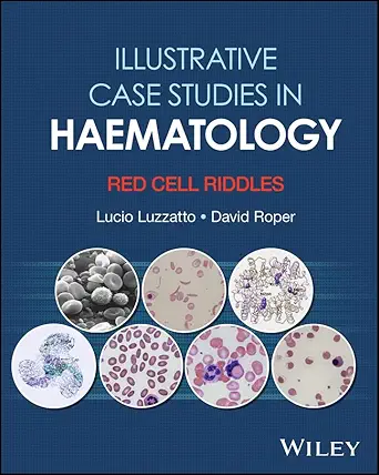 Illustrative Case Studies in Haematology: Red Cell Riddles (PDF) Illustrative Case Studies in Haematology: Red Cell Riddles (PDF)