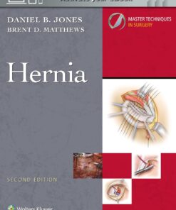 Master Techniques in Surgery: Hernia, 2nd Edition (Videos only)